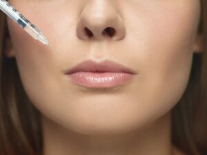 Ce-proceduri-de-marire-a-buzelor-pot-incerca